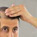 أسباب تساقط الشعر و كيفية المحافظة على شعر صحي