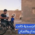 نجاح وأبداع بعد الإعاقة الجسدية💪🏻